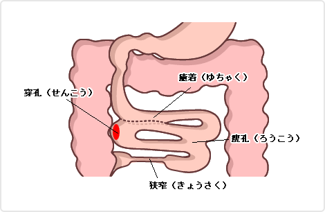 病 と は クローン