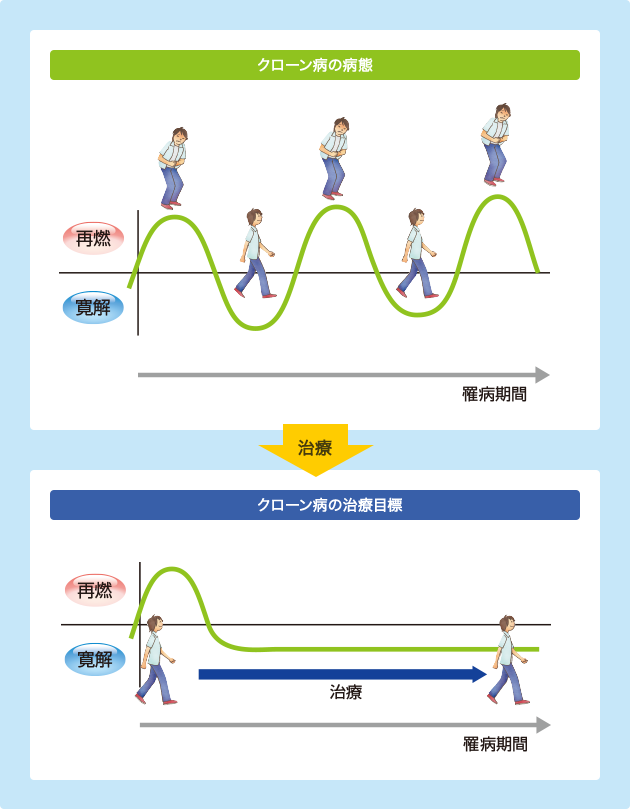 （図）クローン病の治療目標