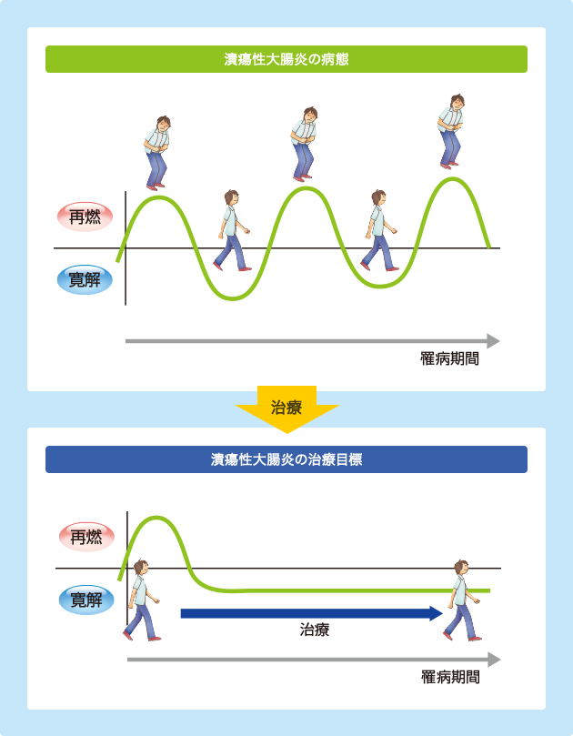 （図）潰瘍性大腸炎の治療目標